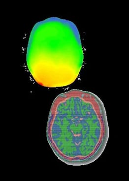 脳波とMRIを組み合わせた場合の安全性を電磁シミュレーションで評価